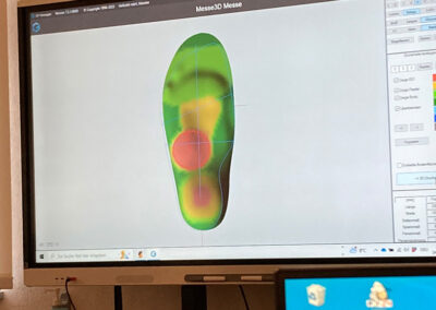 3D Druck in der Orthopädieschuhtechnik